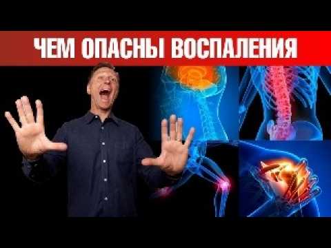 Видео: ГЛАВНЫЕ причины хронического воспаления в организме🧐