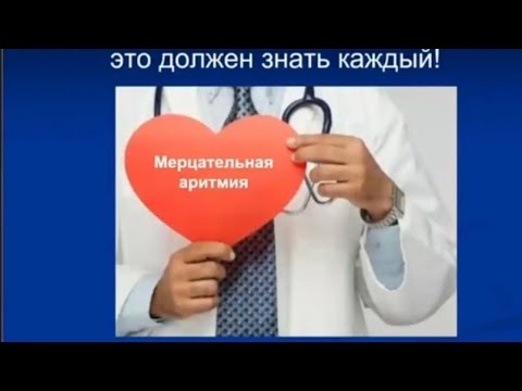 Видео: Мерцательная аритмия (фибрилляция предсердий)