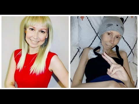 Видео: История Дарьи Антроповой. О чем нельзя разговаривать с онкопациентами?