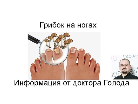 Видео: Грибок на ногах - как бороться?