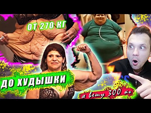 Видео: Я вешу 300 кг! ЧТО БЫЛО ДАЛЬШЕ! История Лоры! ▶ СЕЗОН 3