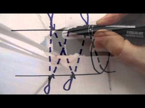 Видео: Сухожильный шов Кюнео