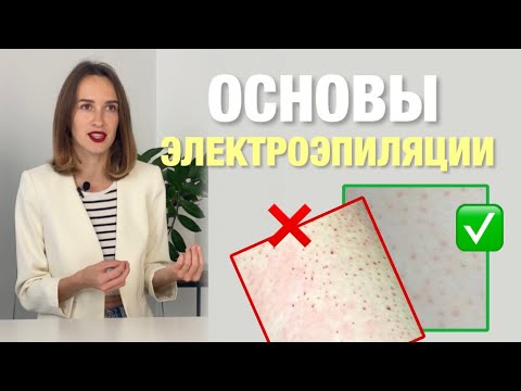 Видео: Основы электроэпиляции - Все ответы на вопросы! Как работает электроэпиляция