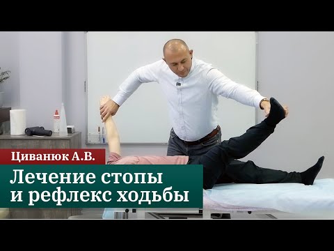Видео: Лечение стопы и рефлекс ходьбы. Циванюк А.В.