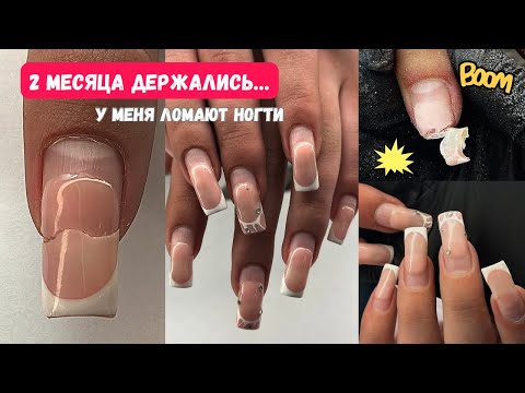 Видео: ШОК! 2 месяца держались… У меня ломают ногти. Боль 😢