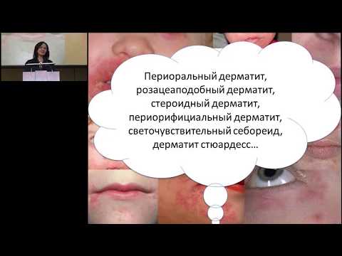 Видео: 18.02.2017 - Периоральный дерматит у детей и взрослых обновленные сведения