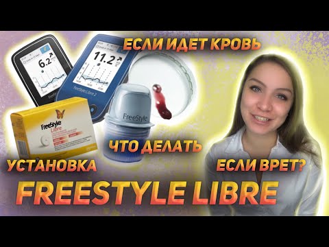 Видео: Freestyle Libre || Установка || Что делать если врет? Пошла кровь || Не работает? || Все ответы тут