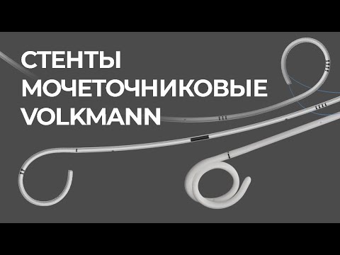 Видео: Стенты мочеточниковые Volkmann