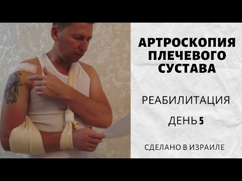 Видео: Реабилитация | Артроскопия плечевого сустава | День пятый