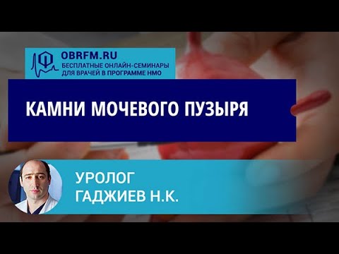 Видео: Уролог Гаджиев Н.К.: Камни мочевого пузыря