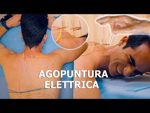 Видео: АСМР: Я ПОПРОБОВАЛА КИТАЙСКУЮ Иглоукалывание ЭЛЕКТРИЧЕСКИМИ ЗАРЯДАМИ!