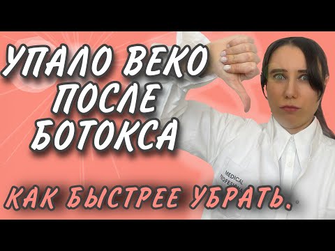 Видео: УПАЛО ОПУСТИЛОСЬ ВЕКО ПОСЛЕ БОТОКСА/УПАЛИ БРОВИ/ИСТИННЫЙ ПТОЗ/ОСЛОЖНЕНИЯ БОТОКС.