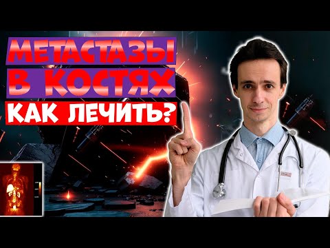 Видео: МЕТАСТАЗЫ в КОСТИ: как лечить? Современные методы в онкологии