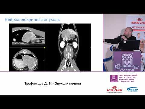 Видео: Трофимцов Дмитрий. Опухоли печени.