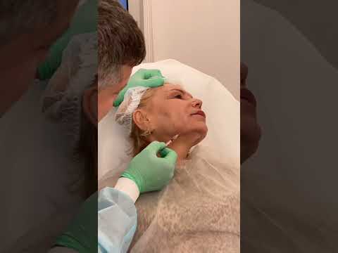 Видео: Коррекция ботулотоксином нижней трети лица.