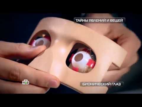 Видео: Бионический глаз вернул зрение незрячему пациенту
