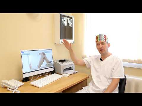 Видео: ТРАВМАТОЛОГИЯ И ОРТОПЕДИЯ | Варианты малоинвазивного лечения верхних и нижних конечностей