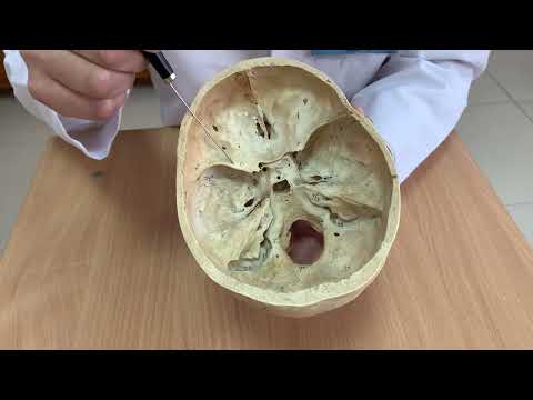 Видео: кости 17 Сына тәрізді сүйек