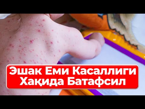 Видео: Эшак Еми Касаллиги Хақида Батафсил | Тарвок Касаллиги