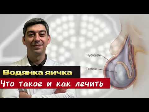 Видео: Как это лечить? Гидроцеле (водянка яичка)