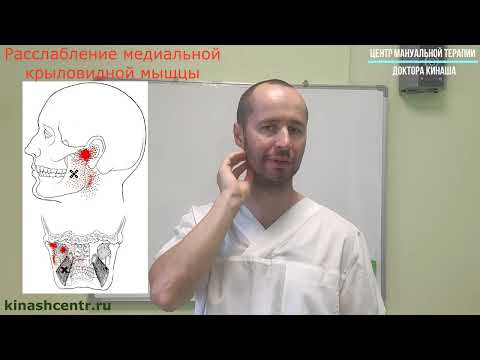 Видео: Расслабление медиальной крыловидной мышцы. Боль в челюсти, глотке, голове.