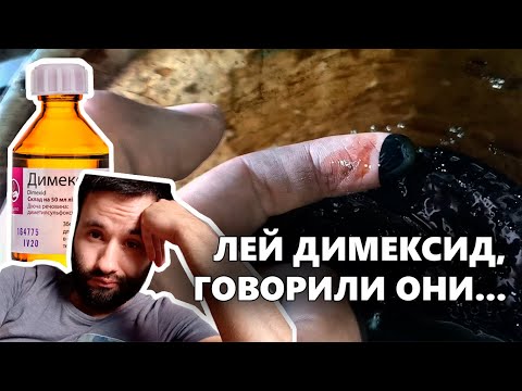 Видео: ДИМЕКСИД & МАСЛОЖОР // А оно вам надо? // Раскоксовка двигателя