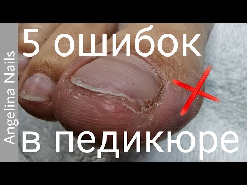 Видео: САМЫЕ распространенные ошибки в педикюре / как избежать проблем и не навредить клиенту /