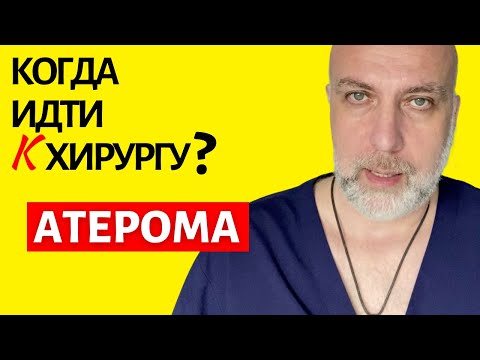 Видео: Атерома (жировик и киста) - когда идти к хирургу | Доктор Елизаров: удаление атеромы лазером