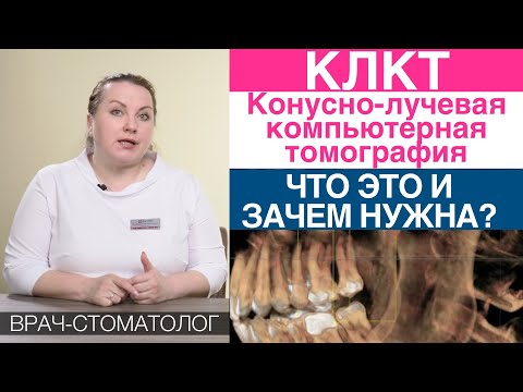 Видео: Конусно-лучевая компьютерная томография (КЛКТ) - при установке зубного импланта, исправление прикуса