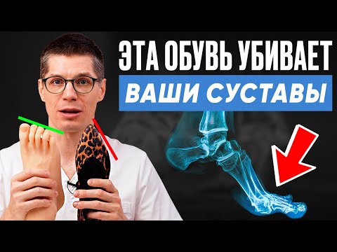 Видео: Никогда не носите ЭТУ ОБУВЬ! 3 самые ВРЕДНЫЕ ПАРЫ обуви для стоп!