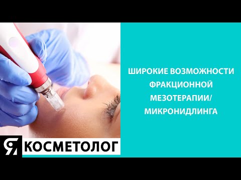 Видео: ШИРОКИЕ ВОЗМОЖНОСТИ ФРАКЦИОННОЙ МЕЗОТЕРАПИИ/МИКРОНИДЛИНГА