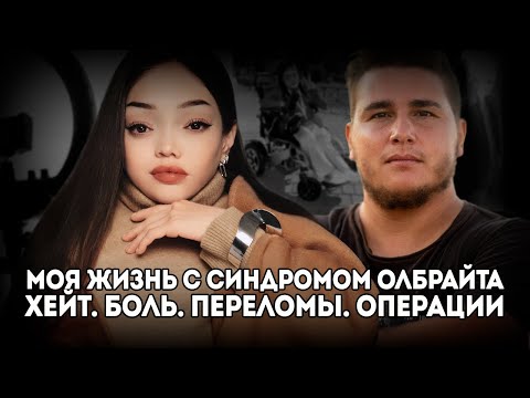 Видео: Как сильная девушка справляется с болью и хейтом - вдохновляющая история Лили с синдромом Олбрайта