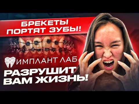 Видео: Брекеты оказались БОЛЬШОЙ ОШИБКОЙ и вот почему