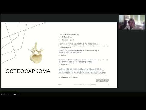 Видео: Редкие опухоли. Опухоли костей (вебинар 22 мая 2024)