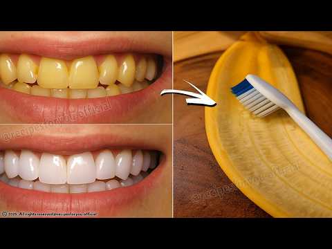 Видео: Тайные стоматологи не хотят, чтобы вы знали: удалите зубной камень и отбелите зубы всего за 2 минуты