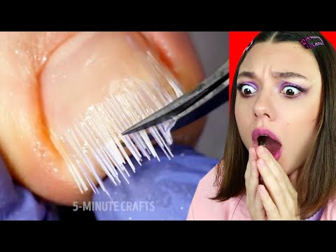 Видео: БЕЗУМНЫЕ ЛАЙФХАКИ ДЛЯ КРАСОТЫ ДЕВОЧЕК! ЧТО С НОГТЯМИ?