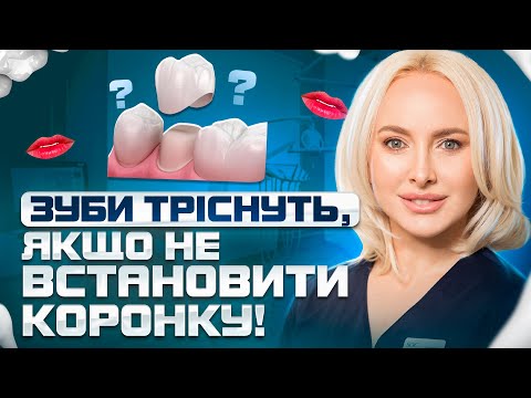 Видео: Під цими КОРОНКАМИ руйнуються зуби! Чому потрібні пломби під коронку? Коли міняти старі коронки?