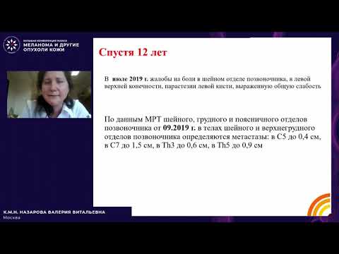 Видео: Меланома и другие опухоли кожи: в поисках оптимальных решений (панельная дискуссия) Кл. случай 3