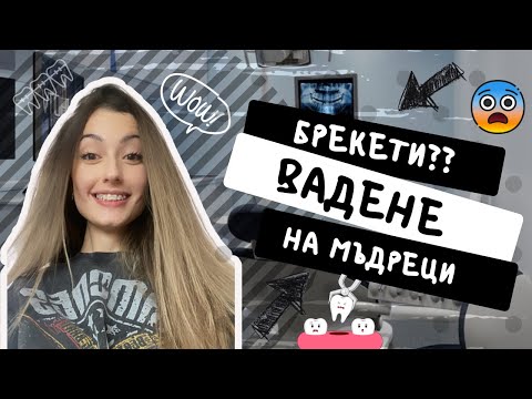 Видео: Вадене на мъдреци | Брекети - Метални или Сапфирени? | Боли ли?