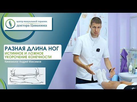 Видео: Разная длина ног. Истинное и ложное укорочение конечности