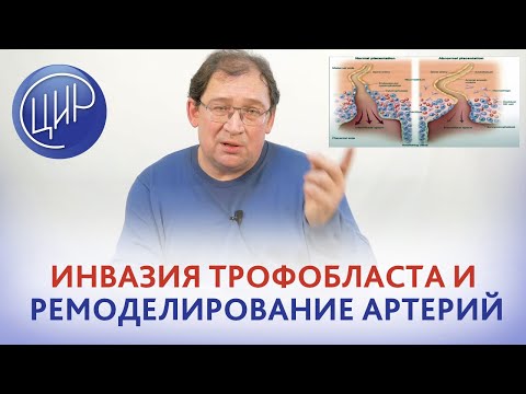 Видео: Плацентация. Инвазия трофобласта и ремоделирование спиральных артерий - в чём разница. Гузов И.И.