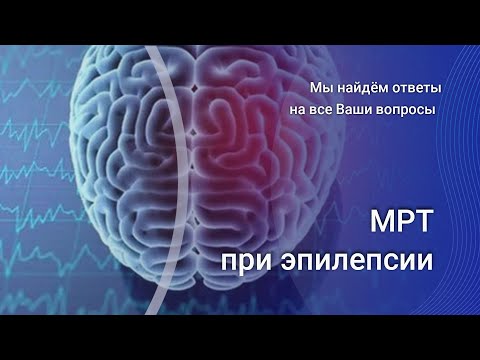 Видео: МРТ при эпилепсии