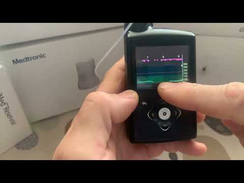 Видео: Опыт использования Medtronic 780g