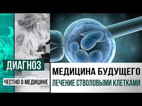 Видео: Что лечат стволовыми клетками в Центре клеточных технологий в Астане | Диагноз