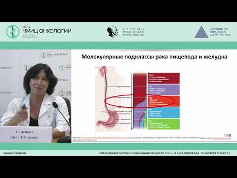 Видео: Современное состояние лекарственного лечения рака пищевода (Семенова А.И.)