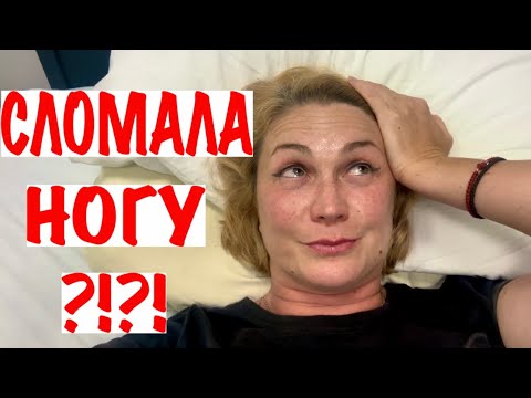 Видео: СЛОМАЛА НОГУ?!