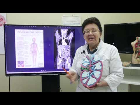 Видео: Лимфома. Симптомы. Методы самопомощи. [Шишова О.И.]