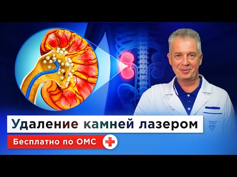 Видео: Как избавиться от камней в почках? Мочекаменная болезнь: причины, диета, лазерное удаление