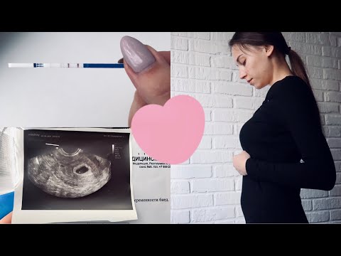 Видео: Я БЕРЕМЕННА🤰🌸 ПЛАНИРОВАНИЕ БЕРЕМЕННОСТИ/ МОЯ РЕАКЦИЯ💕