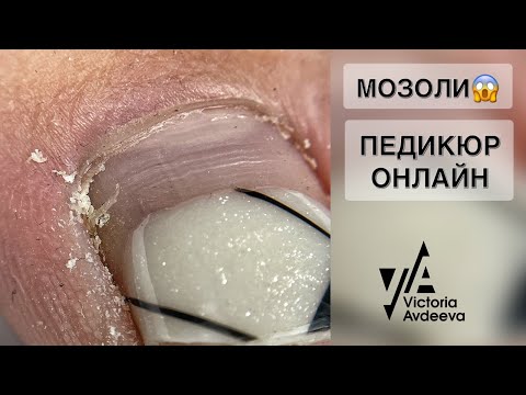 Видео: ПЕДИКЮР ОНЛАЙН.   Виктория Авдеева